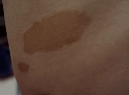 จุดสีลาเต้ในกาแฟนม