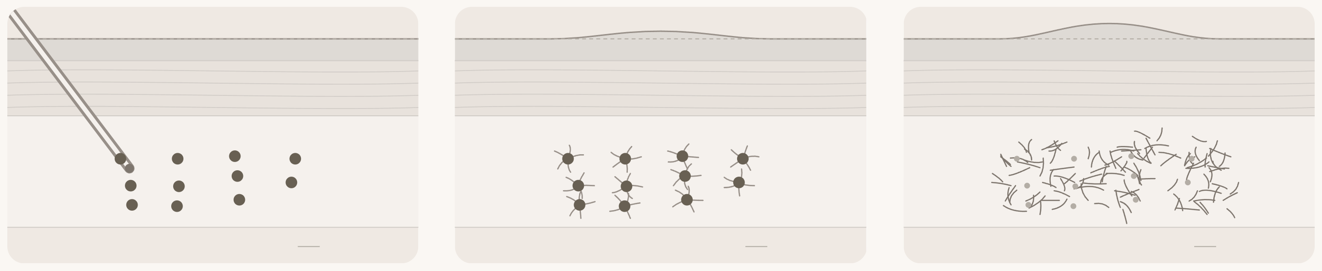 Cross-sectional view of the working principle of the Juvelock volume