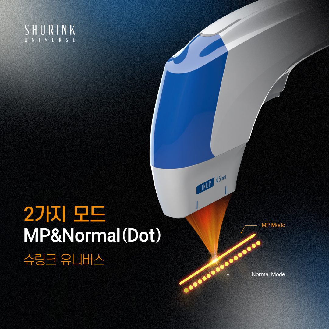MP 모드와 Dot 모드 조사 방식